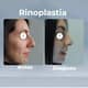 Slider image (9) Dr. Felipe Castro Esguerra - Plastic Surgeon in Colombia